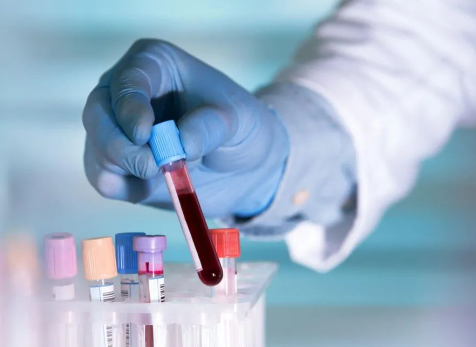 迪諾學(xué)院-IVD大講堂I第二課《試劑項目大分類》