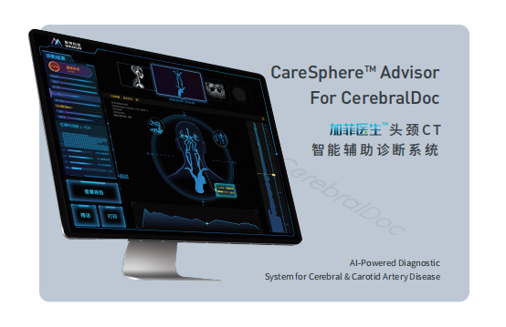 數(shù)坤科技 頭頸CT智能輔助診斷系統(tǒng)