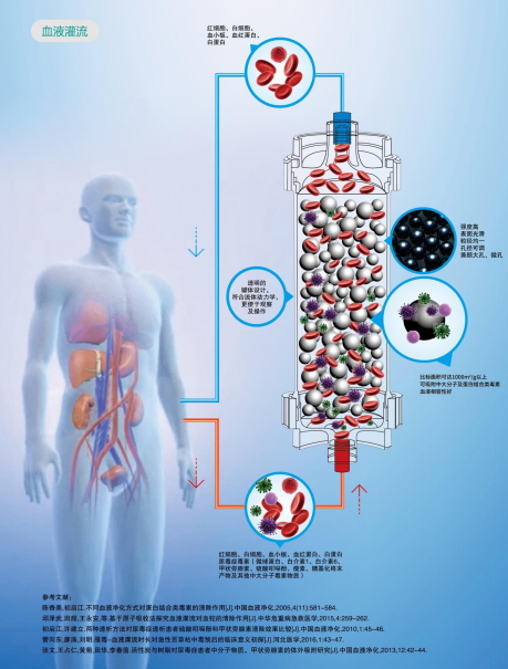 希爾康-RC血液灌流器